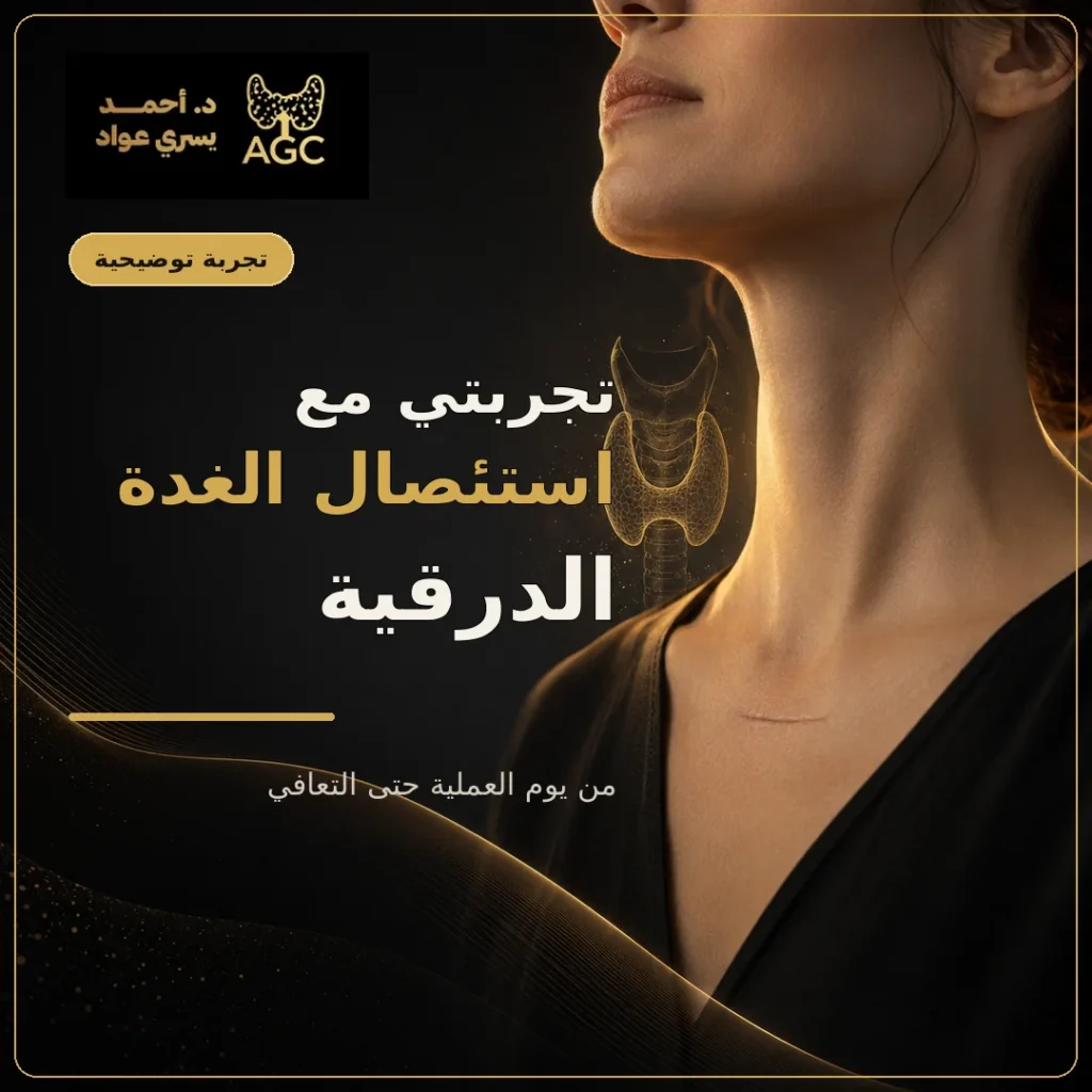 تجربتي مع استئصال الغدة الدرقية