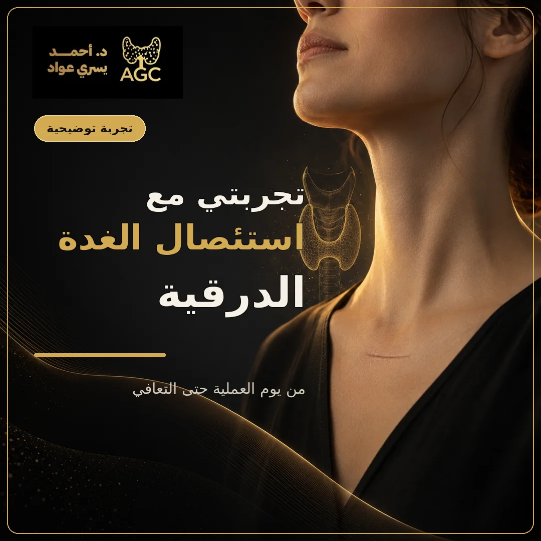 تجربتي مع استئصال الغدة الدرقية