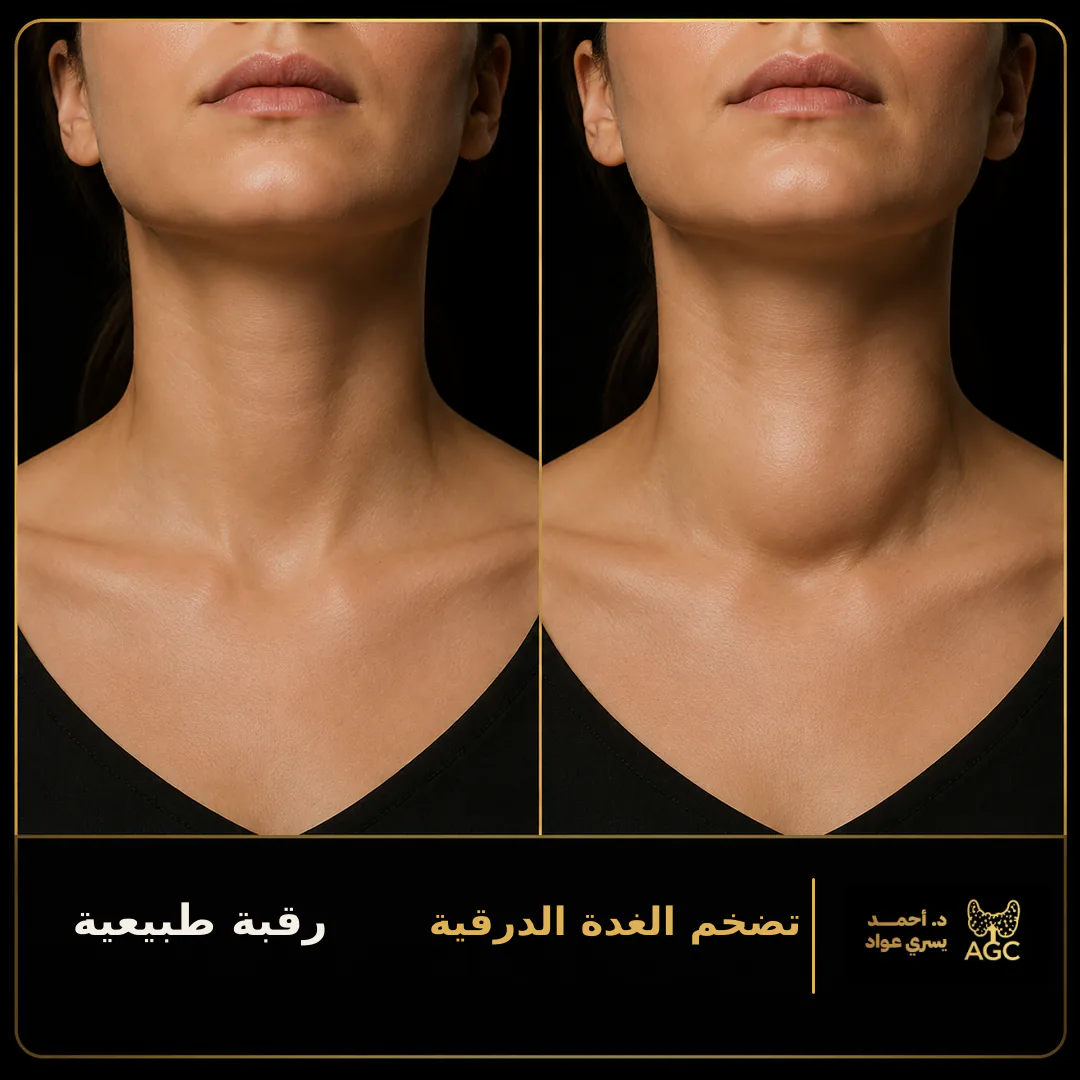 الرقبة الطبيعية وتضخم الغدة الدرقية