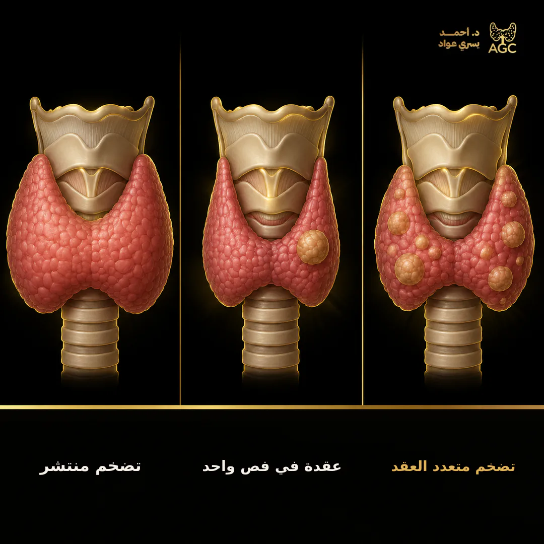 أشكال تضخم الغدة الدرقية