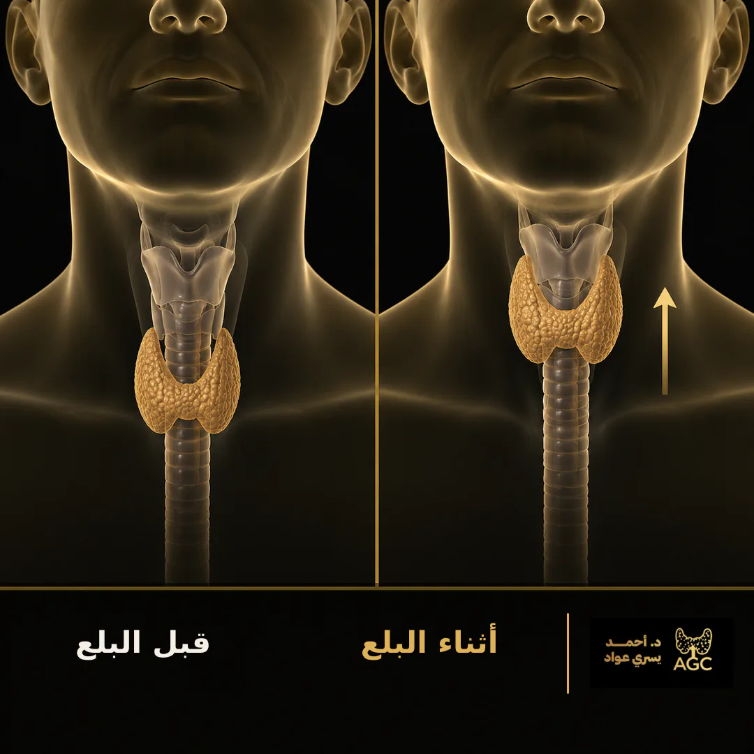 حركة الغدة الدرقية مع البلع