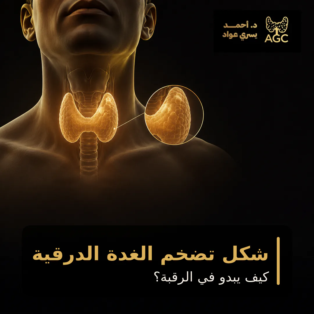 شكل تضخم الغدة الدرقية