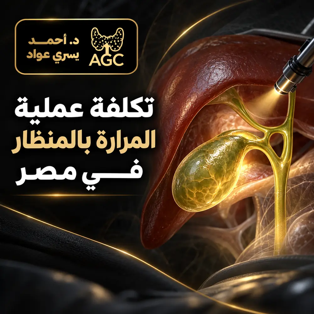 تكلفة عملية المرارة بالمنظار في مصر